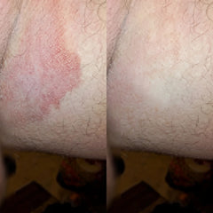 Veloma Antifungal Soap